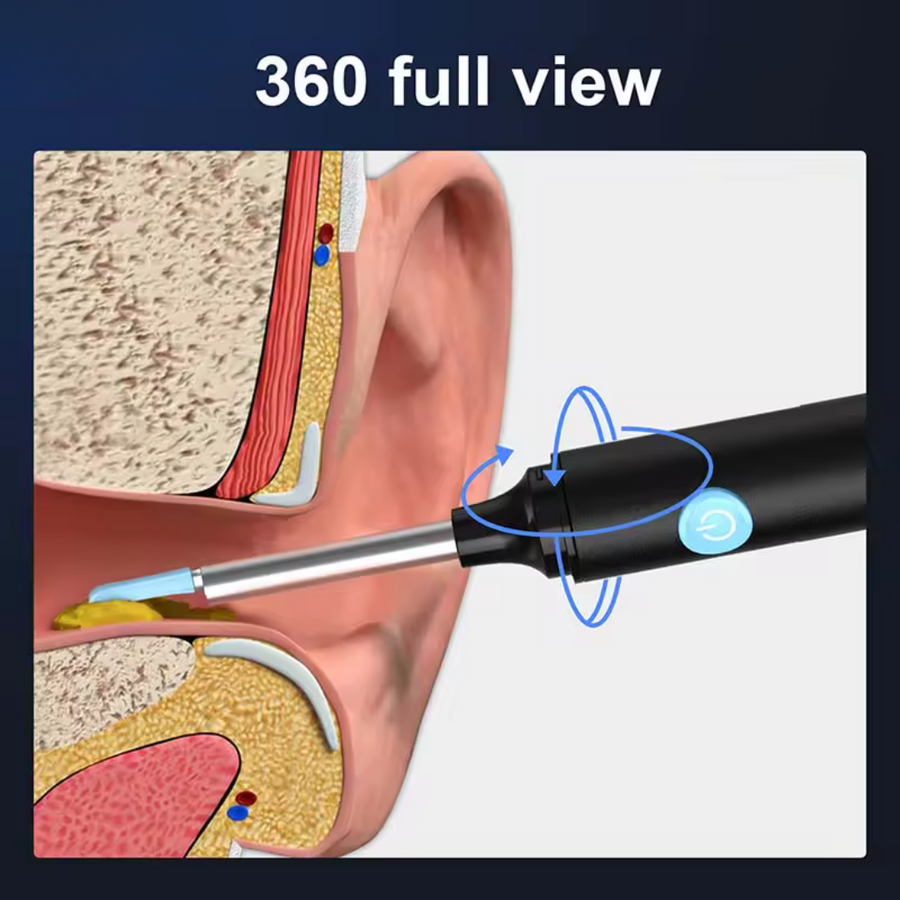 Ear Wax Removal Tool with Camera – HD Ear Cleaner with 6 LED Lights