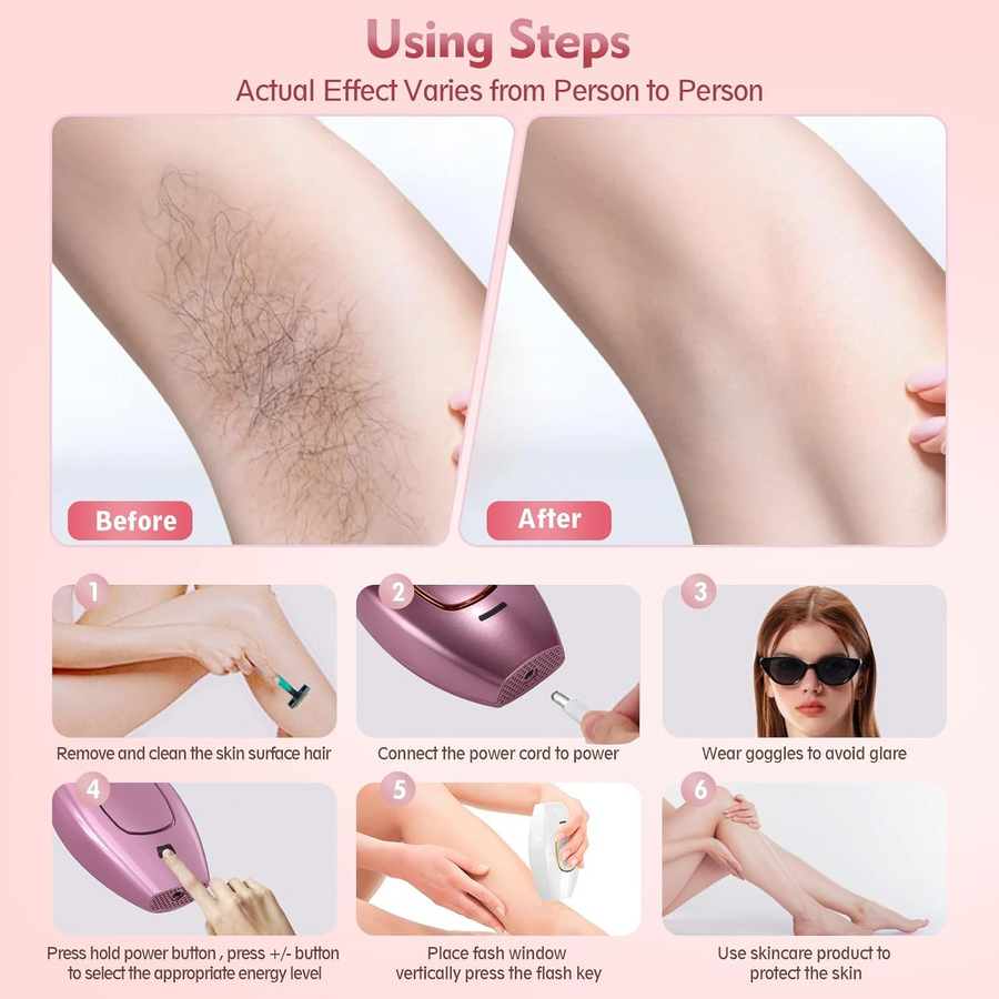 Safe & Effective IPL Permanent Laser Hair Removal Device for Face and Body for Men & Women